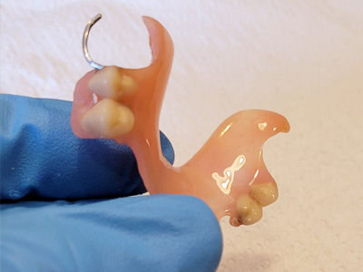 réparation prothèse dentaire à Sambreville